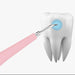 Electric Dental Plaque Remover - Indigo-Temple